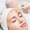 Acne Facial